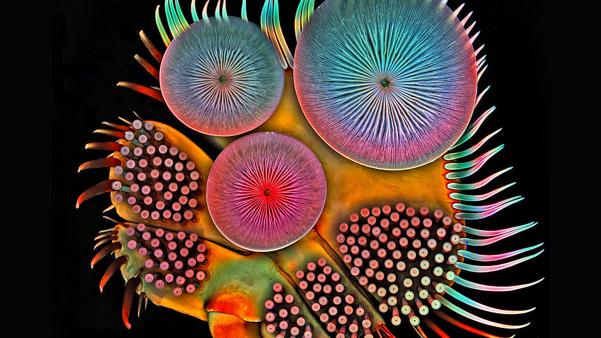 MICROSCOPY MICROSCOPY